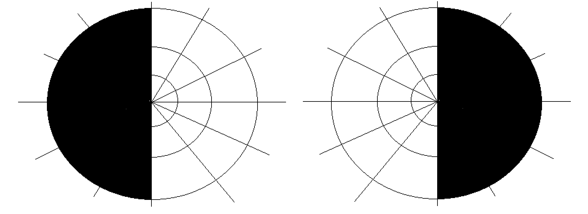 Campimetria dos dois olhos, lado a lado, com metade de cada campo visual preenchida de preto.